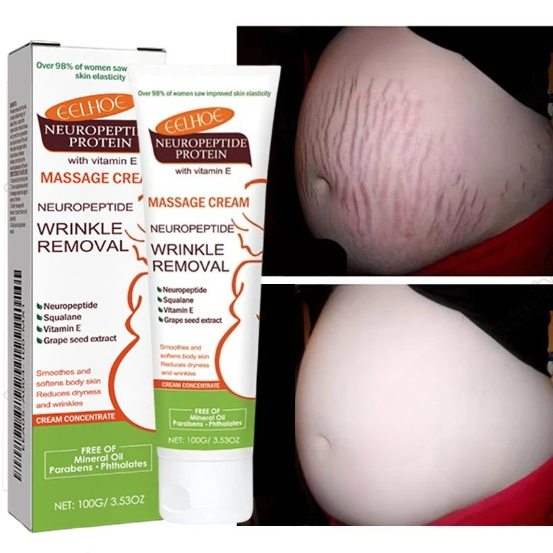 Teeth Whitening Pregnancy - 100 グラムストレッチマーク永久除去クリームマタニティ妊婦妊娠抗しわスムーズ修復引き締め肌ボディケア