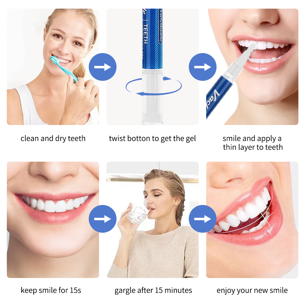 Vaclav-歯のホワイトニングペン,漂白ジェル,汚れの除去 - Teeth Whitening Gel Pen のレビューと価格