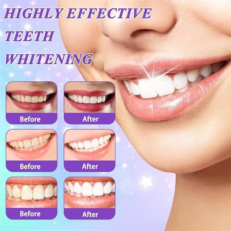 9D パープル歯磨き粉ムース 黄ばんだ歯の汚れ除去用集中ステ - Teeth Whitening Toothpaste のレビューと価格