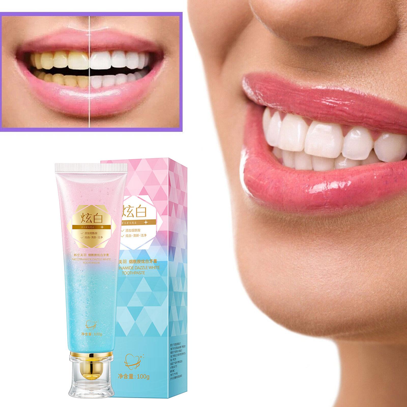 ナイアシンアミド美白歯磨き粉口腔ケア口臭汚れ除去歯垢を減らす - Teeth Whitening Toothpaste のレビューと価格