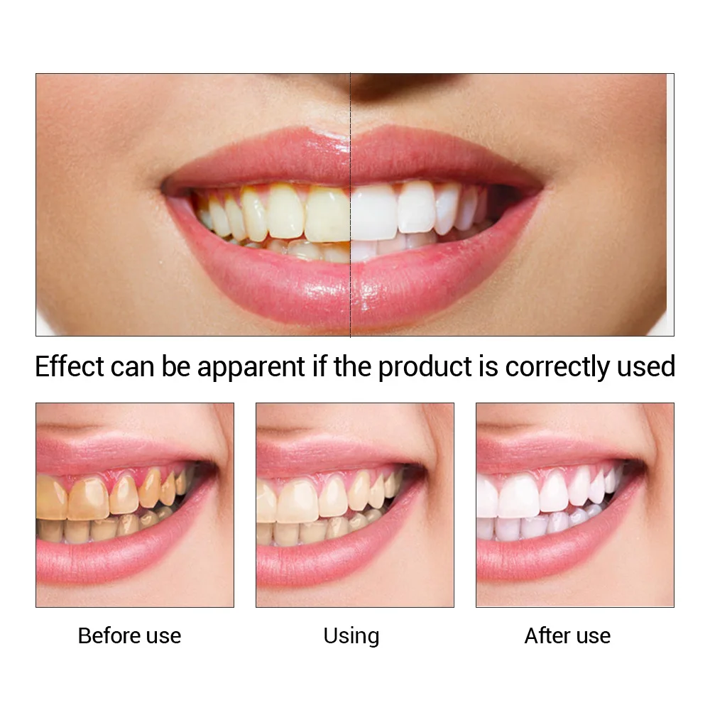 歯のホワイトニングエッセンス,口腔衛生,歯のホワイトニング, - Teeth Whitening Toothpaste のレビューと価格