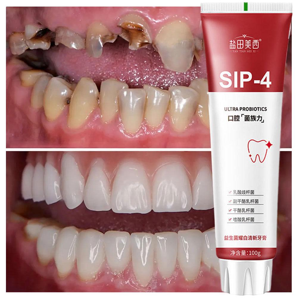 100g Sip-4 プロバイオティクスホワイトニング歯磨き - Teeth Whitening Toothpaste のレビューと価格